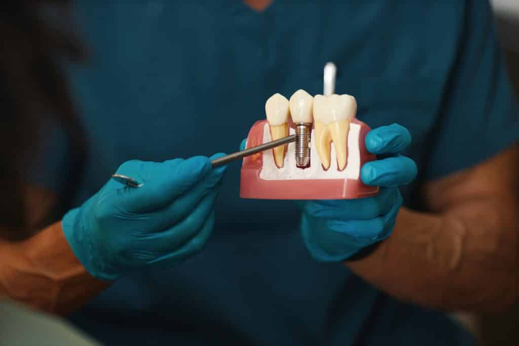 Implant-Supported Dentures Attleboro